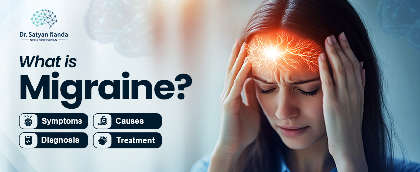 What is Migraine? Symptoms, Causes, Diagnosis & Treatment
