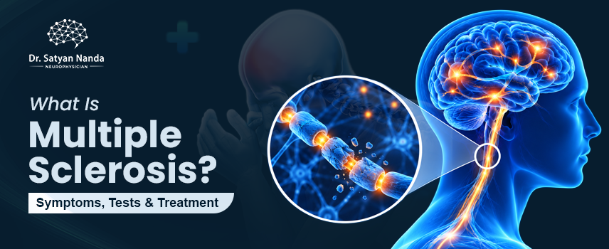 What Is Multiple Sclerosis? Symptoms, Diagnosis & Treatment